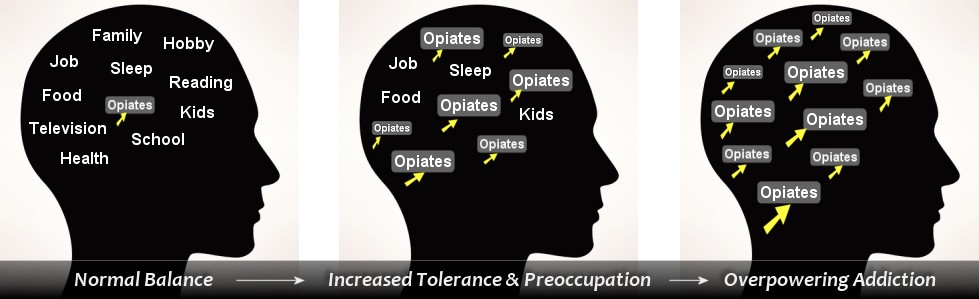 opiate addiction progression